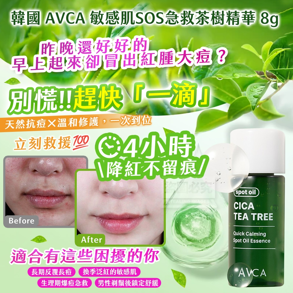 韓國製造 4小時退紅~AVCA 敏感肌SOS急救茶樹精華 8g