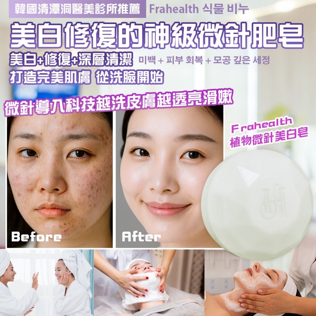 韓國製造 Frahealth +PDRN 再生亮白微針皂 買一送一/組