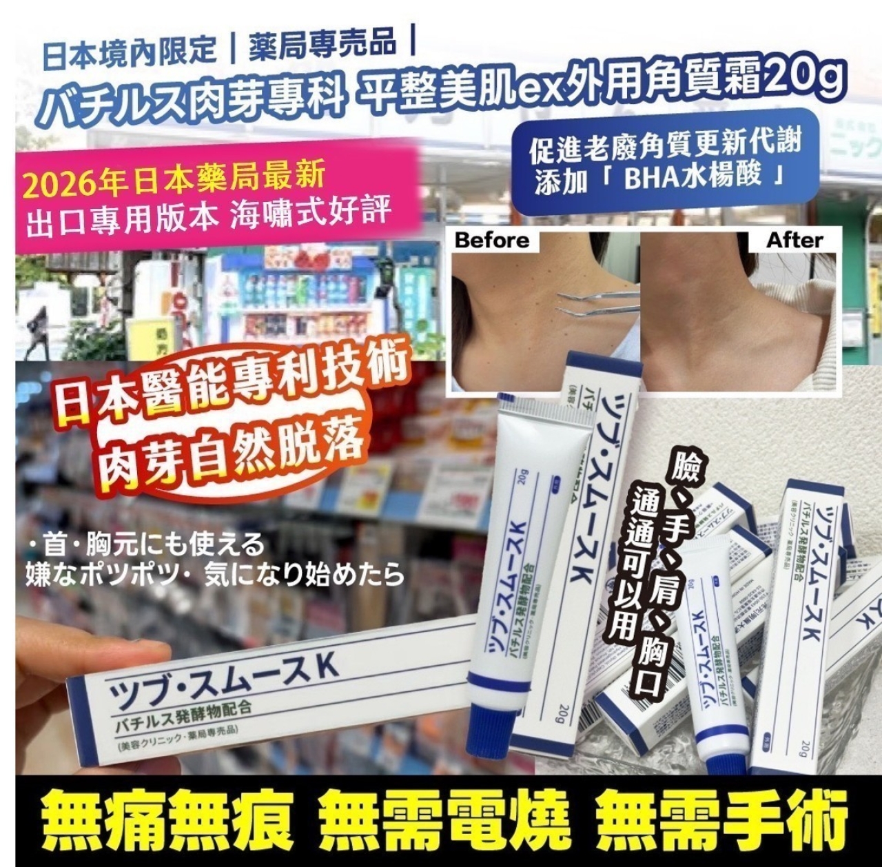 日本境內限定 薬局専売品 バチルス肉芽專科 平整美肌ex外用角質霜20g