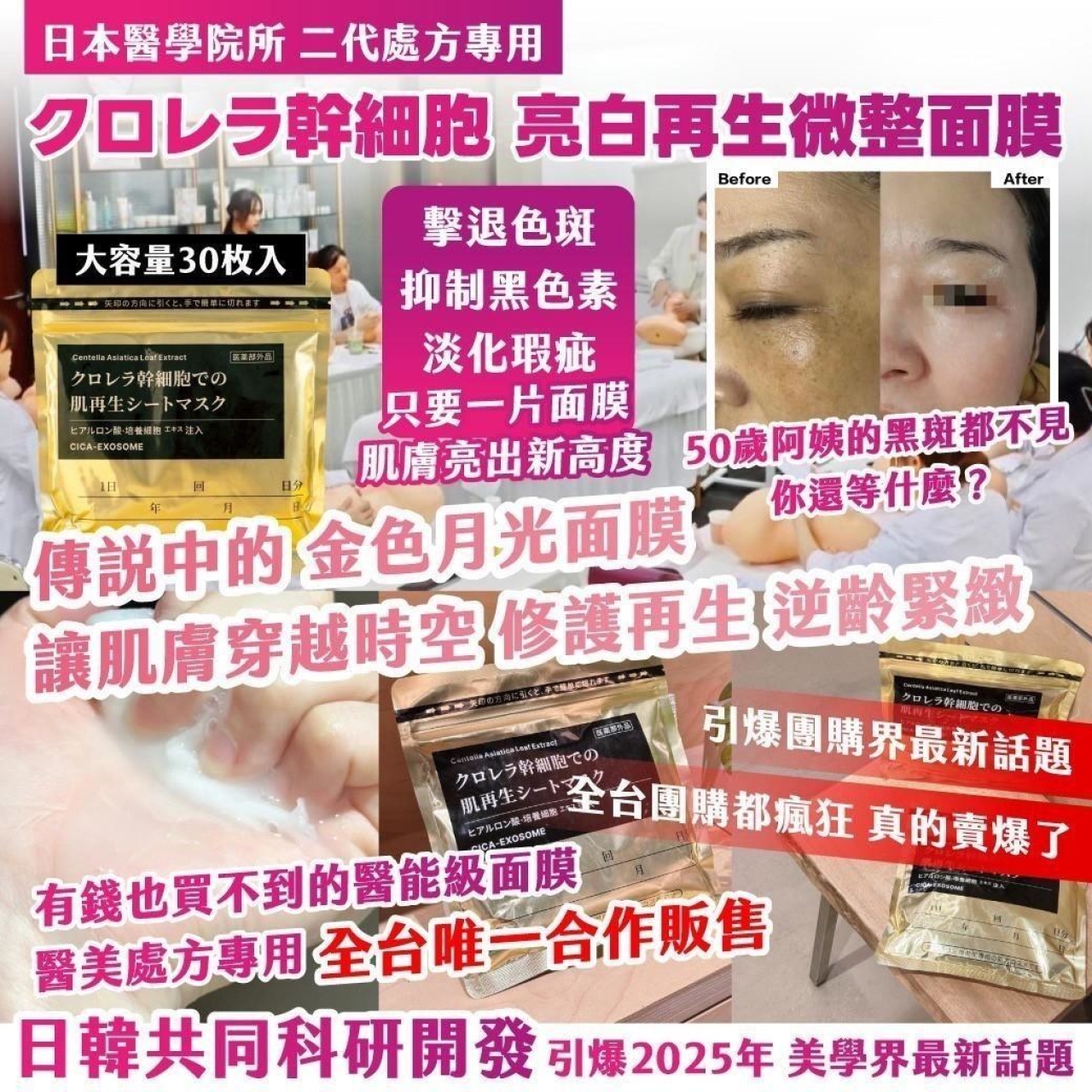 日本醫學院所 二代處方專用 クロレラ幹細胞 亮白再生微整面膜