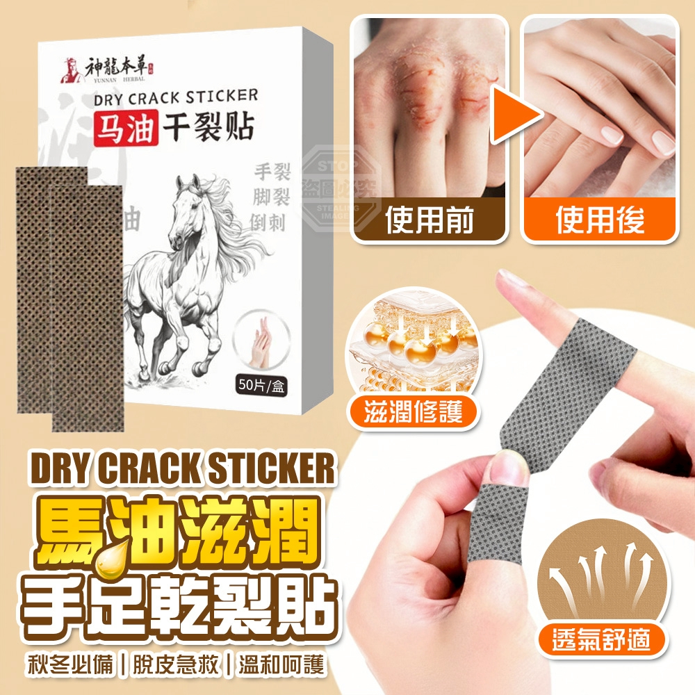 (2組)秋冬必備馬油滋潤急救脫皮手足乾裂貼-買一送一/組