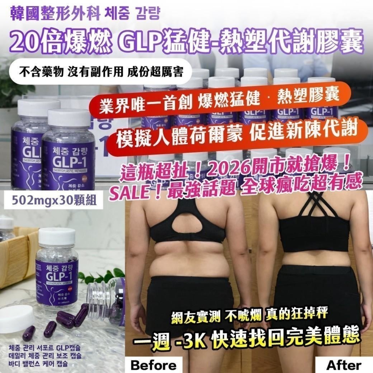 韓國整形外科 체중 감량 20倍爆燃 GLP猛健-熱塑代謝膠囊